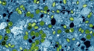 Schulschließung wegen Mpox - Was bedeutet das?