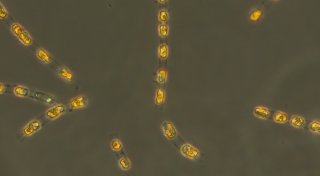 7.000 Jahre alte Alge wieder zum Leben erweckt