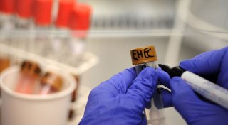 EHEC-Infektionen in Norddeutschland: Was macht die Bakterien so gefährlich?