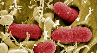 Häufung von Ehec-Infektionen - wie gefährlich ist das?