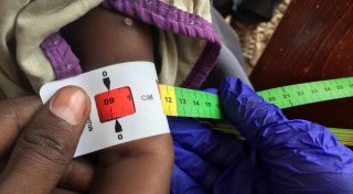 Fortschritte gegen den Hunger - aber nicht überall