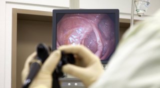Krebsdiagnose bei Darmspiegelung: Vorsorge hat Bünderin das Leben gerettet