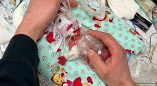 Winziges Baby mit 265 Gramm in Passau geboren