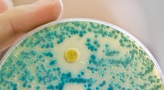 Experten alarmiert wegen Antibiotikaresistenzen
