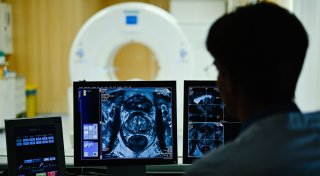 Prostatakrebs: Was Männer wissen sollten