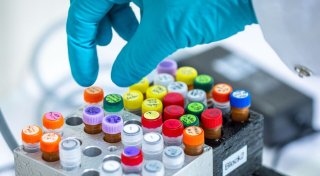 Zwei Menschen in Deutschland nach Ehec-Infektion gestorben