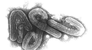 WHO: Offenbar acht Tote durch Marburg-Virus in Tansania