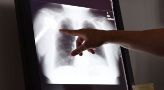 Verdacht auf Behandlungsfehler? Das können Sie nun tun