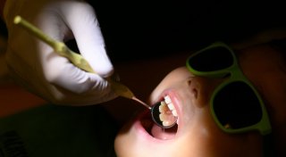 Karies beim Kind vorbeugen: Was Eltern wissen müssen