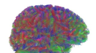 Kindheit bis Alter - Gehirnstruktur durchläuft fünf Phasen