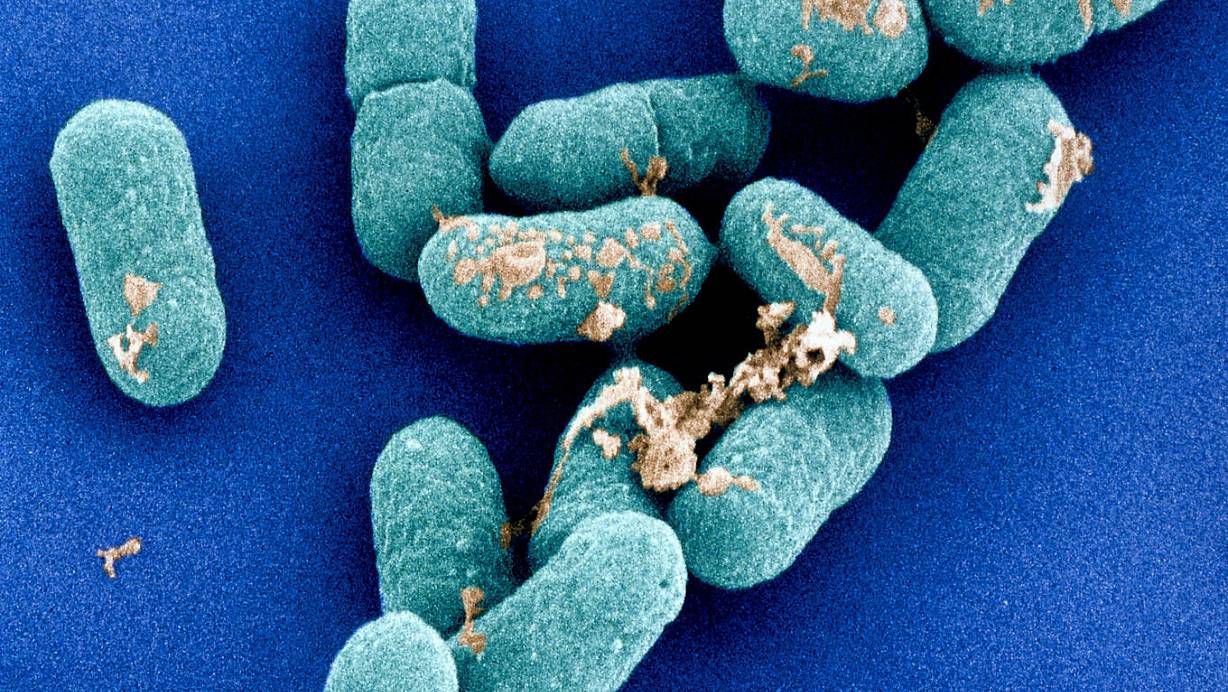Es gibt verschiedene Formen von Listerien, aber nur ein Erreger ist wirklich gefährlich: Listeria monocytogenes. | © picture-alliance / OKAPIA KG, Germany