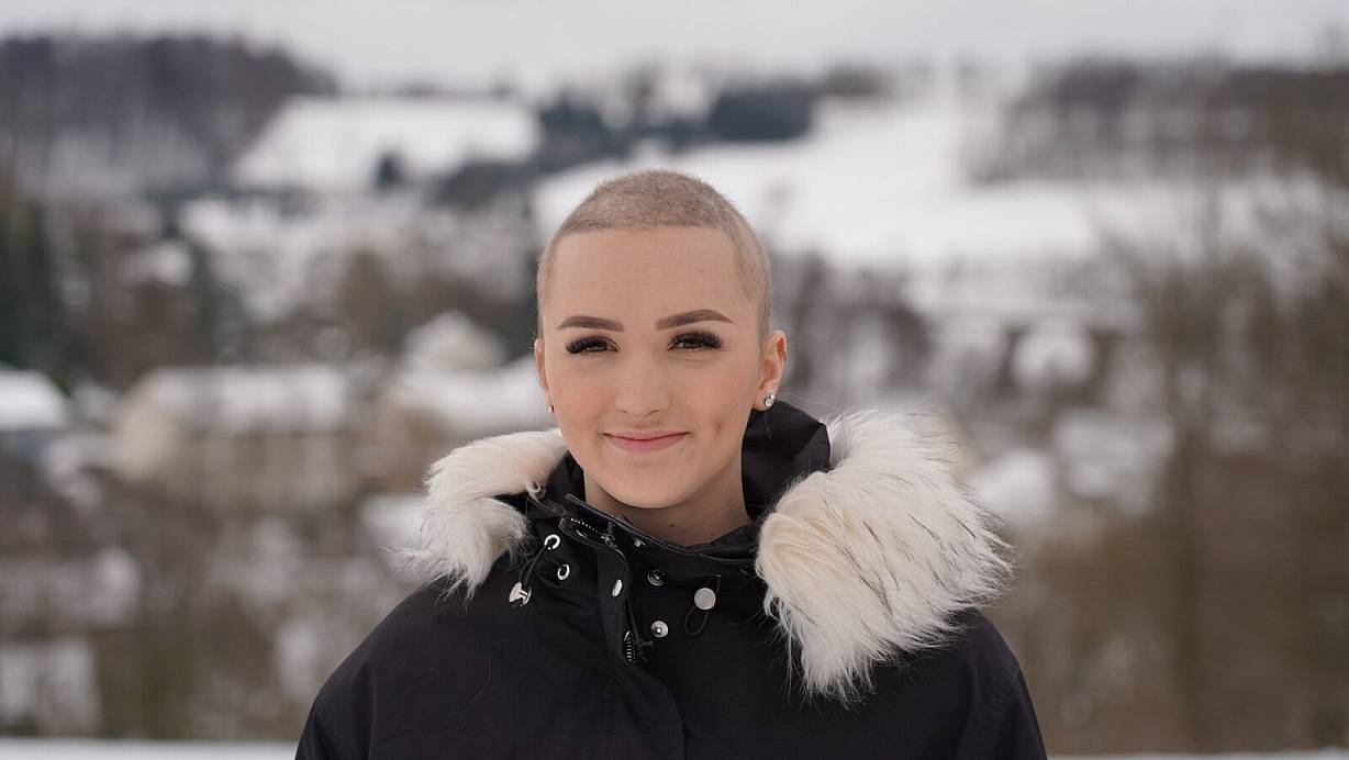An Weihnachten 2021 fallen Julia Fischer plötzlich die Haare aus. Später entscheidet sie sich dazu, eine Glatze zu rasieren. | © Julia Fischer
