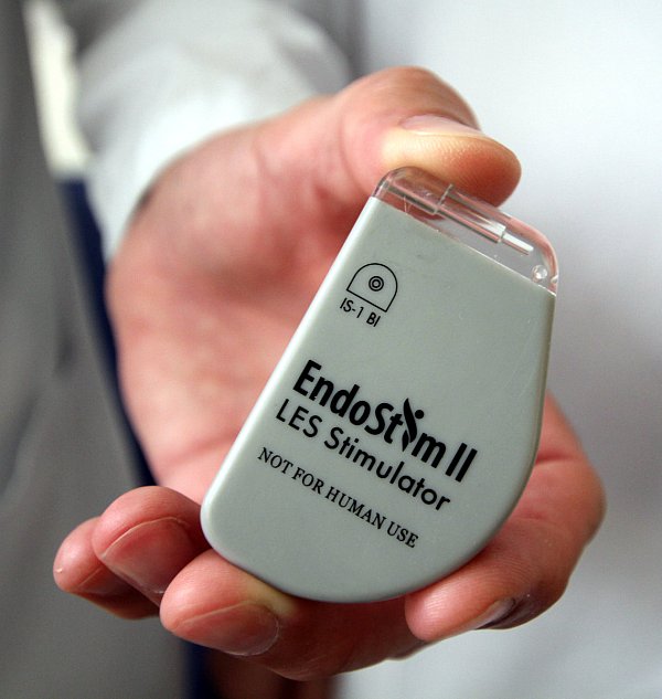 Schrittmacher: Hiermit wird der Speiseröhrenmuskel angeregt. - © NW