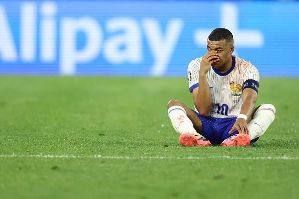 Kylian Mbappe hält sich im Spiel der Franzosen gegen Österreich seine gebrochene Nase. - © AFP or licensors