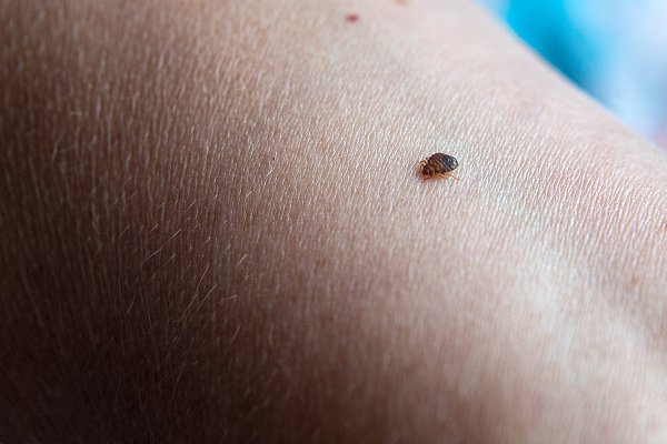 Die Wanzen saugen Blut und leben in bewohnten geschlossenen Räumen. - © Sina Schuldt