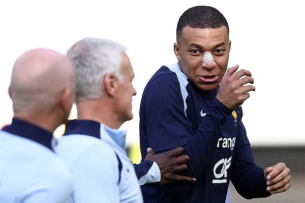 Frankreich-Stürmer Kylian Mbappe trägt ein Pflaster über seiner gebrochenen Nase. - © AFP or licensors