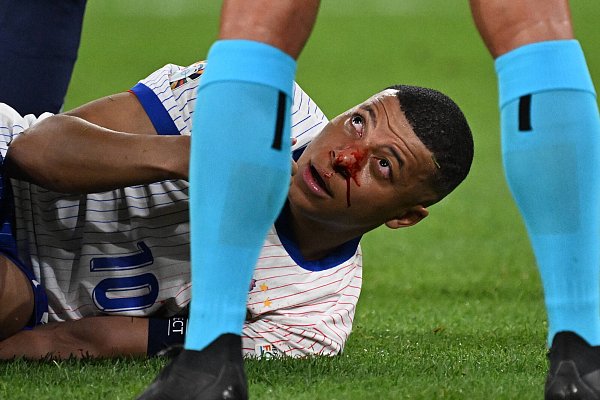 Kylian Mbappé liegt mit blutender Nase auf dem Boden. - © IMAGO/Jan Huebner