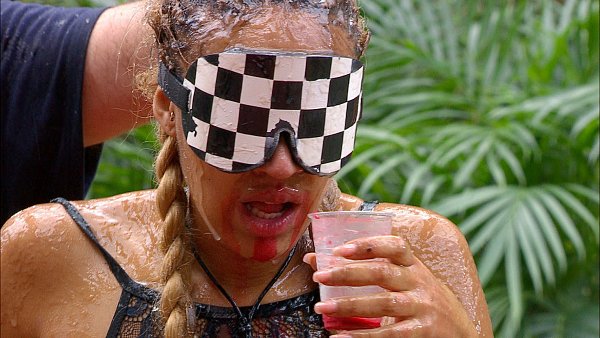 Sarah Joelle Jahnel kann am Emu-Blut nichts finden. - © RTL