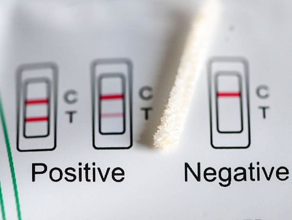 Positiv oder negativ - das zeigt ein Test an. (Symbolbild) - © Jens Kalaene/dpa
