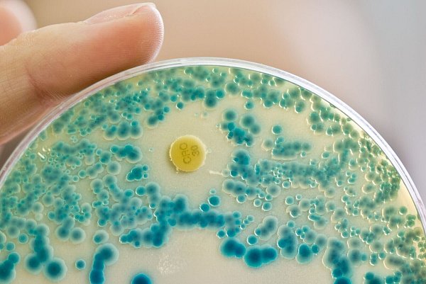 Dass Antibiotika nicht mehr wirken, wird für die Menschheit zunehmend zum Problem. (Archivbild) - © Daniel Karmann/dpa