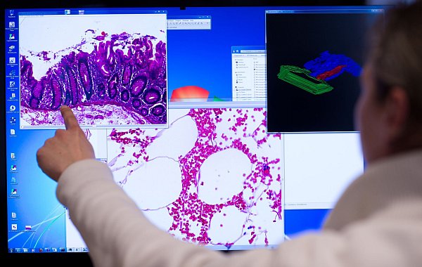 Darmkrebs ist die dritthäufigste Tumorerkrankung in Deutschland. (Archivbild) - © picture alliance / Bernd von Jutrczenka/dpa