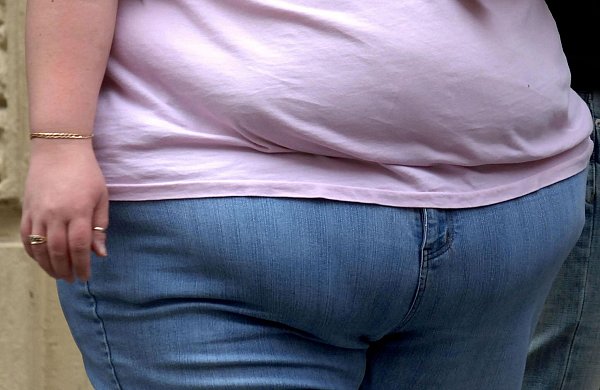 Übergewicht ist ein erhebliches Gesundheitsrisiko. (Symbolbild) - © Clara Molden/PA Wire/dpa