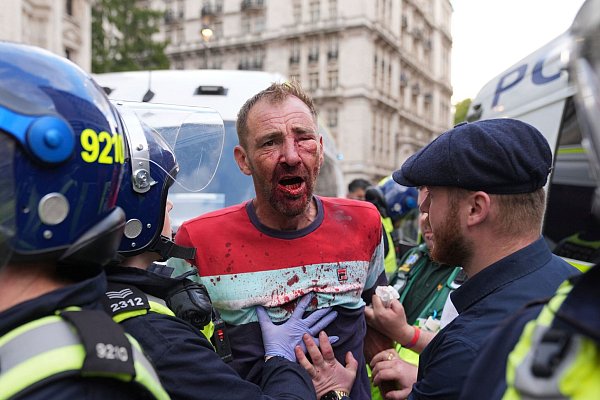 An mehreren Stellen kam es zu Zusammenstößen mit der Polizei. - © Lucy North/PA Wire/dpa