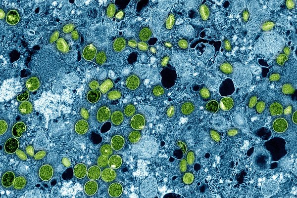 Diese kolorierte elektronenmikroskopische Aufnahme aus dem Jahr 2024 zeigt Mpox-Viruspartikel (grün). (Archivbild) - © -/NIAID via AP/dpa