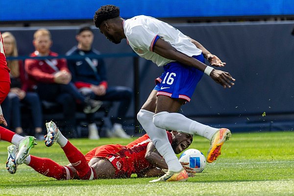Alphonso Davies (unten) verletzte sich im Länderspiel gegen die USA. - © Ringo Chiu/ZUMA Press Wire/dpa