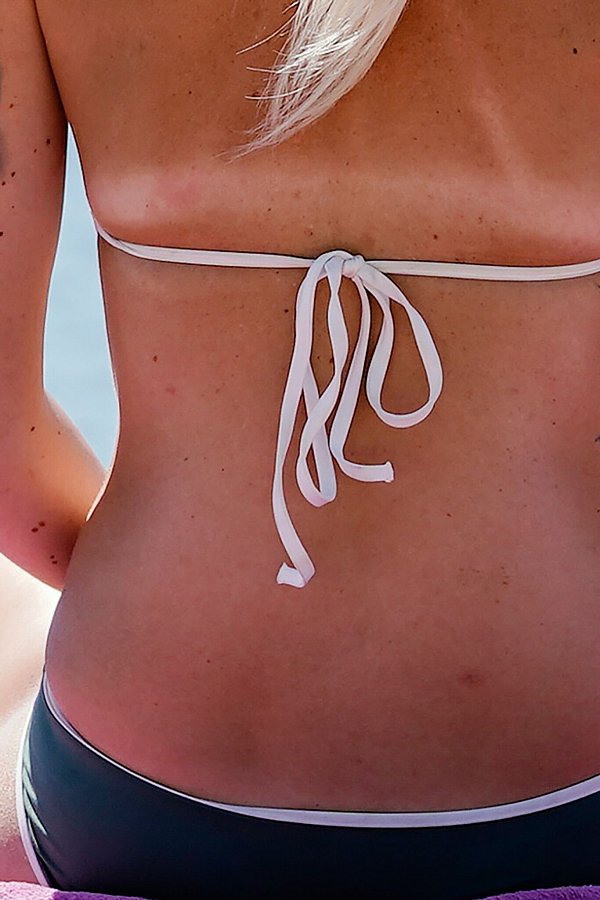 «Tanlines» sind ein Trend, bei dem sich die blassen Stellen der Haut deutlich von einem gebräunten Körper abzeichnen. Gesund ist das aber nicht. - © Uwe Anspach/dpa/dpa-tmn