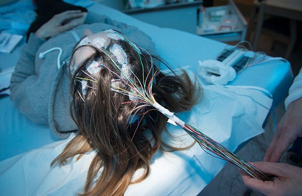 Eine Überaktivität des Gehirns, ganz plötzlich: Wer von Epilepsie betroffen ist, erlebt Anfälle oft aus heiterem Himmel. - © Friso Gentsch/dpa/dpa-tmn