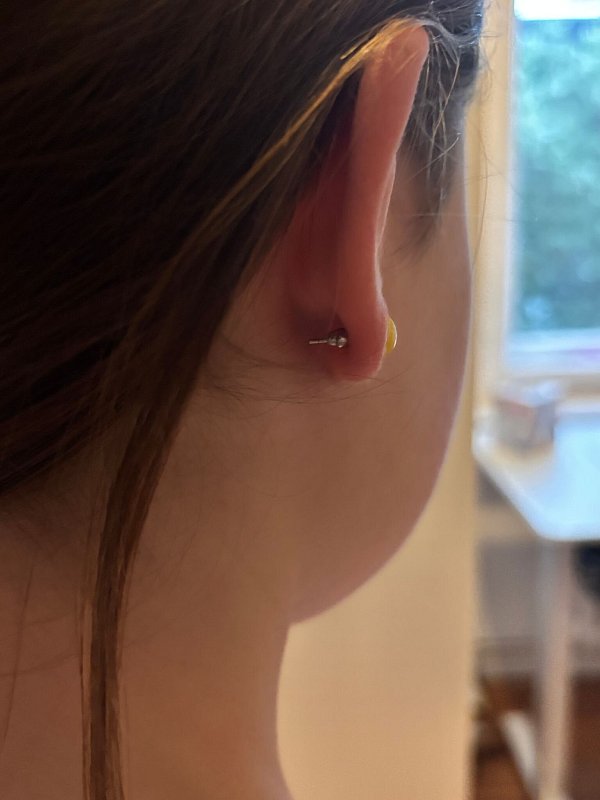 Verheilt alles gut? Eltern und Kind sollten das in den Wochen nach dem Ohrlochstechen immer wieder checken. - © Tom Nebe/dpa-tmn