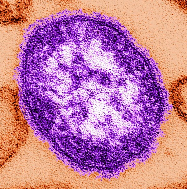 Die USA haben derzeit mit einem Masernausbruch zu kämpfen - insbesondere der Bundesstaat Texas. (Archivbild) - © Cynthia Goldsmith/Centers for Disease Control and Prevention/dpa