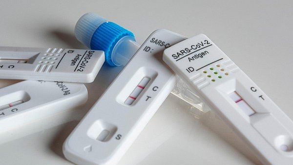 Die einzelnen Komponenten des Testkits können unterschiedliche Verfallsdaten haben. - © Symbolbild/Pixabay
