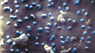 Nano-Aufnahmen zeigen Coronaviren an Zelle