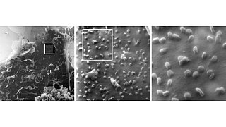 Nano-Aufnahmen zeigen Coronaviren an Zelle
