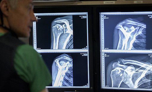 Osteoporose erhöht das Risiko für Knochenbrüche massiv. - picture alliance / BSIP