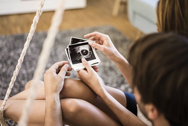 Frauen bleibt nach einer Fehlgeburt oft nur ein Ultraschallbild ihres Kindes. - © picture alliance / Westend61
